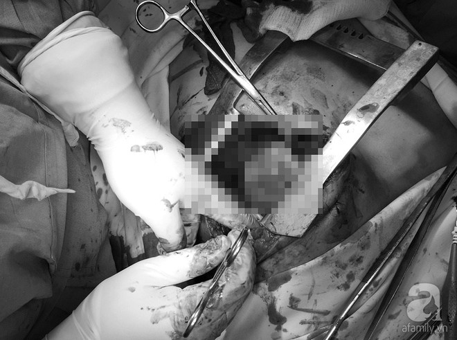 Đang chạy xe, người đàn ông ngã gục với vết thương thủng tim tại phố đi bộ Nguyễn Huệ - Ảnh 1. Đang chạy xe, người đàn ông ngã gục với vết thương thủng tim tại phố đi bộ Nguyễn Huệ - Ảnh 1.