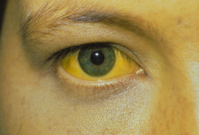 Đoán bệnh qua 2 điểm trên khuôn mặt để biết rõ tình trạng sức khoẻ hiện tại - Ảnh 3.