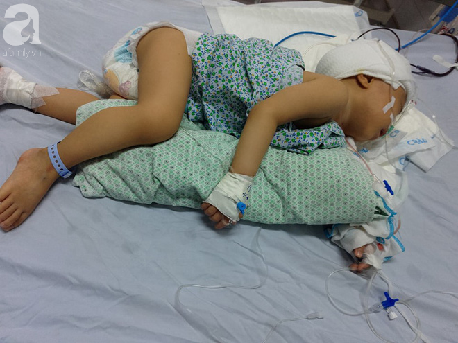 Bé trai 1 tuổi bị hẹp hộp sọ đã phẫu thuật thành công sau khi nhận được gần 50 triệu đồng từ các nhà hảo tâm - Ảnh 3.