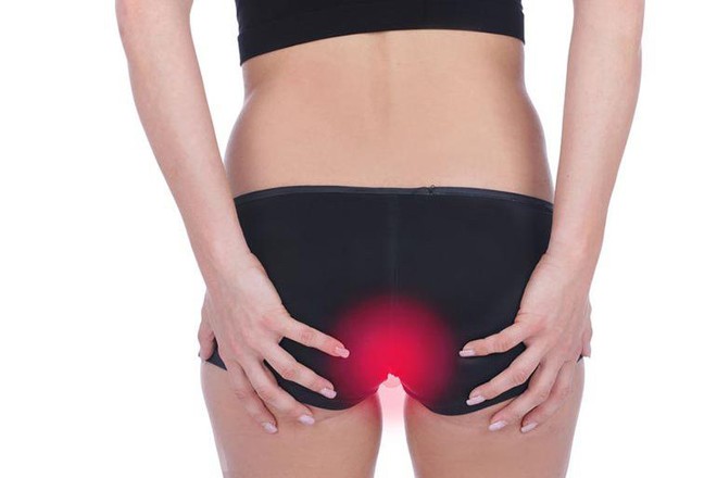 7 nguyên nhân gây ngứa ở mông rất có thể nghiêm trọng hơn bạn nghĩ - Ảnh 3. 7 nguyên nhân gây ngứa ở mông rất có thể nghiêm trọng hơn bạn nghĩ - Ảnh 3.