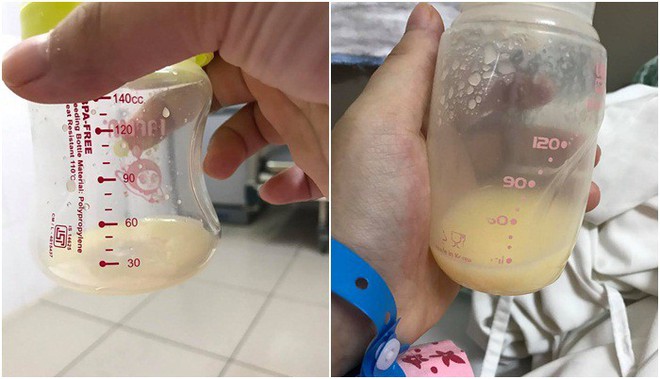 Kinh nghiệm kích sữa từ lúc chỉ láng đáy bình cho đến khi đủ sữa cho 2 bé sinh đôi bú cùng lúc - Ảnh 1.
