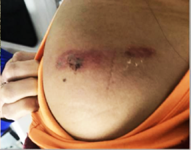 Ngủ trong mùng, bé gái 11 tuổi ở TP.HCM bị con rết dài 30 cm chui vào cắn trọng thương - Ảnh 1.
