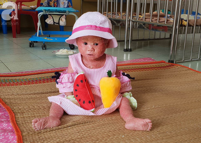 Cuộc sống của bé gái 14 tháng tuổi người đầy vẩy ngứa như da trăn và nhiều em nhỏ khác ở Trung tâm Bảo trợ xã hội - Ảnh 7.