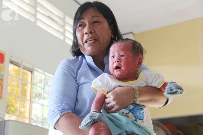 Cuộc sống của bé gái 14 tháng tuổi người đầy vẩy ngứa như da trăn và nhiều em nhỏ khác ở Trung tâm Bảo trợ xã hội - Ảnh 6.