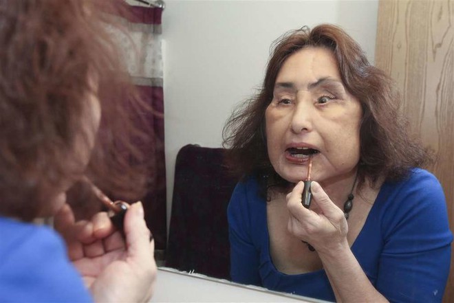 Gã chồng ghen tuông “san phẳng” khuôn mặt vợ bằng một phát súng oan nghiệt, 4 năm sau điều không tưởng đã xảy ra - Ảnh 5. Gã chồng ghen tuông “san phẳng” khuôn mặt vợ bằng một phát súng oan nghiệt, 4 năm sau điều không tưởng đã xảy ra - Ảnh 5.
