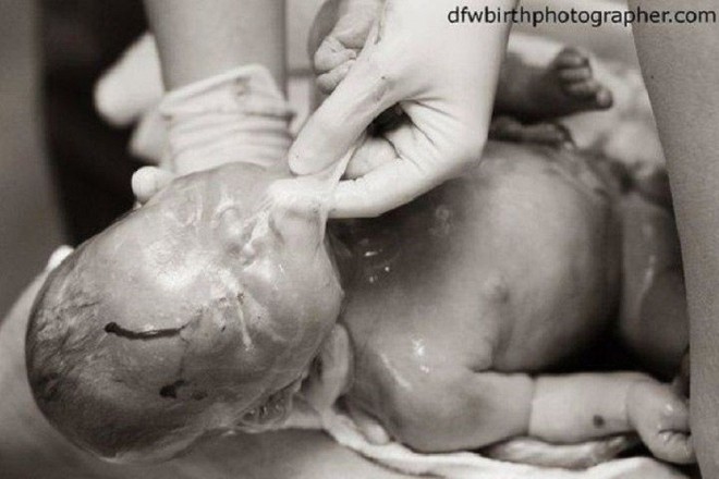 Những bức ảnh sinh nở cực hiếm khi em bé chào đời còn nguyên trong túi ối - Ảnh 10.