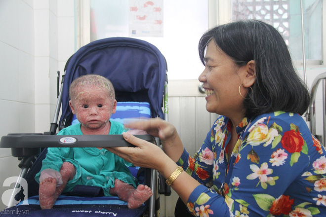 Bé Bích 14 tháng tuổi bị bố mẹ bỏ rơi, người đầy vẩy ngứa như da trăn đã nhập viện Da Liễu TP.HCM để điều trị - Ảnh 4.