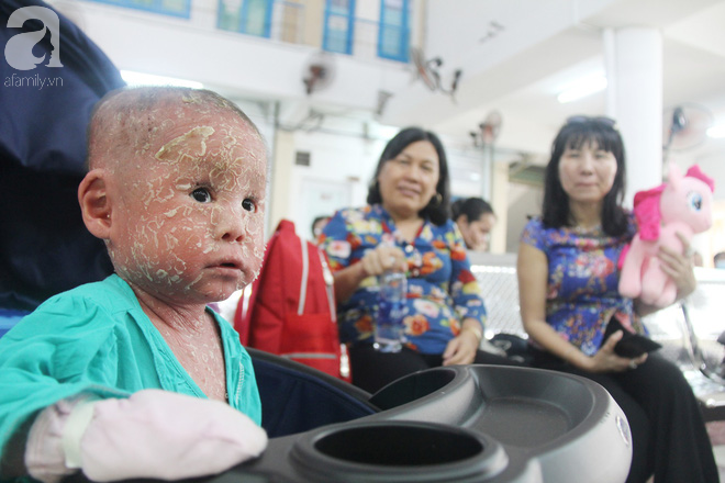 Bé Bích 14 tháng tuổi bị bố mẹ bỏ rơi, người đầy vẩy ngứa như da trăn đã nhập viện Da Liễu TP.HCM để điều trị - Ảnh 14.