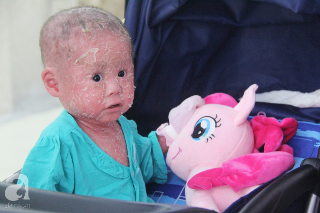 Bé Bích 14 tháng tuổi bị bố mẹ bỏ rơi, người đầy vẩy ngứa như da trăn đã nhập viện Da Liễu TP.HCM để điều trị - Ảnh 15.