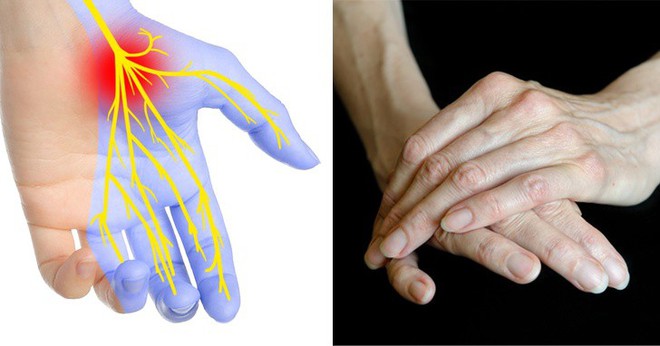 Hãy xòe đôi bàn tay ra trước mặt: Bạn có thể đoán bệnh qua 7 dấu hiệu này trên tay - Ảnh 3.