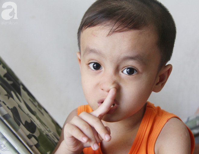 Bố bị điện giật cháy cả người không có tiền chữa, bé trai 4 tuổi sợ hãi nép vào lòng mẹ vì không nhận ra - Ảnh 12. Bố bị điện giật cháy cả người không có tiền chữa, bé trai 4 tuổi sợ hãi nép vào lòng mẹ vì không nhận ra - Ảnh 12.