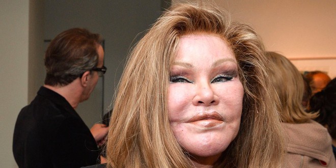 Cuộc đời tai tiếng của “miêu nữ” tỷ phú Jocelyn Wildenstein: Chi núi tiền phẫu thuật giống mèo để chiều chồng, cuối cùng nhận về kết cục đắng ngắt - Ảnh 6.