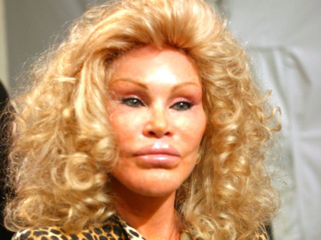 Cuộc đời tai tiếng của “miêu nữ” tỷ phú Jocelyn Wildenstein: Chi núi tiền phẫu thuật giống mèo để chiều chồng, cuối cùng nhận về kết cục đắng ngắt - Ảnh 10.