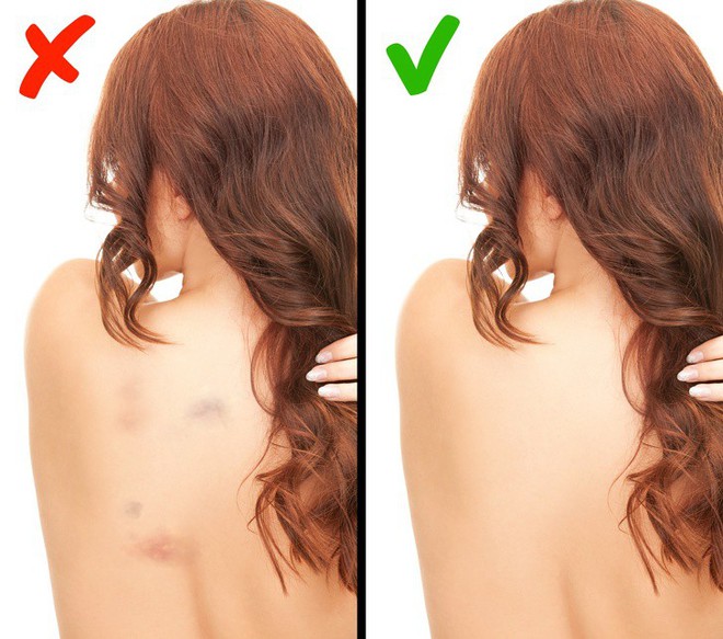 Tốt nhất là bạn đừng lờ đi 7 tín hiệu cảnh báo cơ thể đang gặp rắc rối như thế này - Ảnh 3. Tốt nhất là bạn đừng lờ đi 7 tín hiệu cảnh báo cơ thể đang gặp rắc rối như thế này - Ảnh 3.
