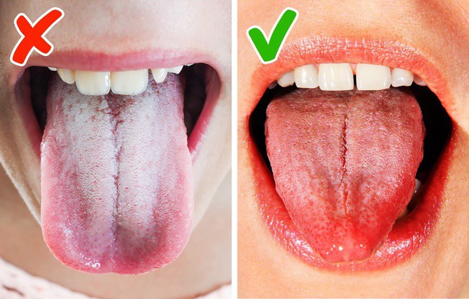 Tốt nhất là bạn đừng lờ đi 7 tín hiệu cảnh báo cơ thể đang gặp rắc rối như thế này - Ảnh 4. Tốt nhất là bạn đừng lờ đi 7 tín hiệu cảnh báo cơ thể đang gặp rắc rối như thế này - Ảnh 4.