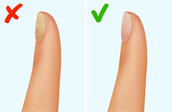 Tốt nhất là bạn đừng lờ đi 7 tín hiệu cảnh báo cơ thể đang gặp rắc rối như thế này - Ảnh 6. Tốt nhất là bạn đừng lờ đi 7 tín hiệu cảnh báo cơ thể đang gặp rắc rối như thế này - Ảnh 6.