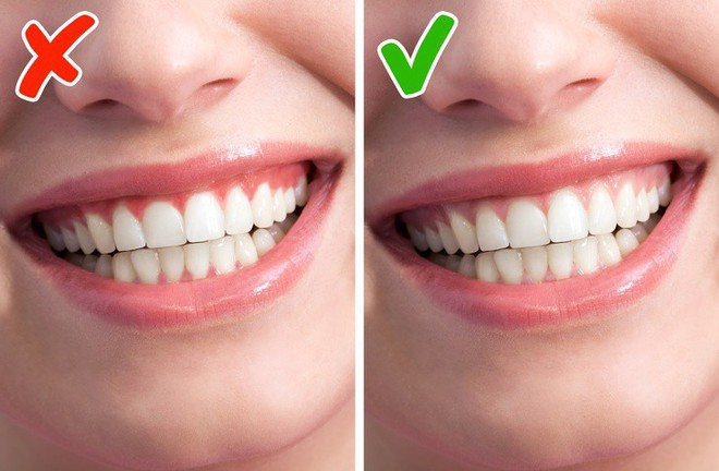 Tốt nhất là bạn đừng lờ đi 7 tín hiệu cảnh báo cơ thể đang gặp rắc rối như thế này - Ảnh 7. Tốt nhất là bạn đừng lờ đi 7 tín hiệu cảnh báo cơ thể đang gặp rắc rối như thế này - Ảnh 7.