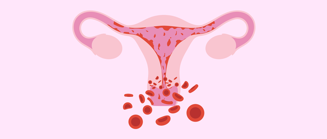5 bệnh thường gặp ở cổ tử cung mà con gái không nên chủ quan bỏ qua - Ảnh 3.