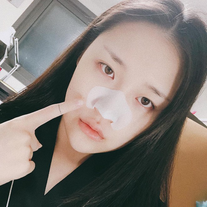 Theo bác sĩ da liễu, miếng dán lột mụn không hề tốt, và đây là cách thay thế mà bạn nên áp dụng - Ảnh 3.