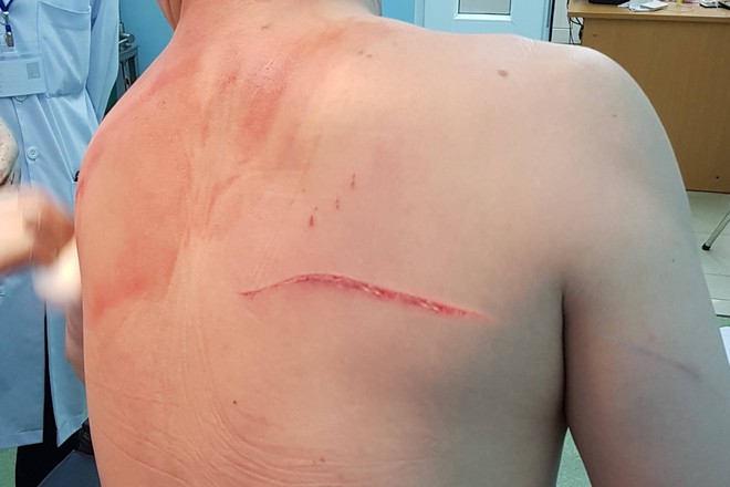 Vụ bác sĩ Chiêm Quốc Thái bị giang hồ chém ở trung tâm Sài Gòn: Bắt giữ nghi can chính là người vợ cũ - Ảnh 3.