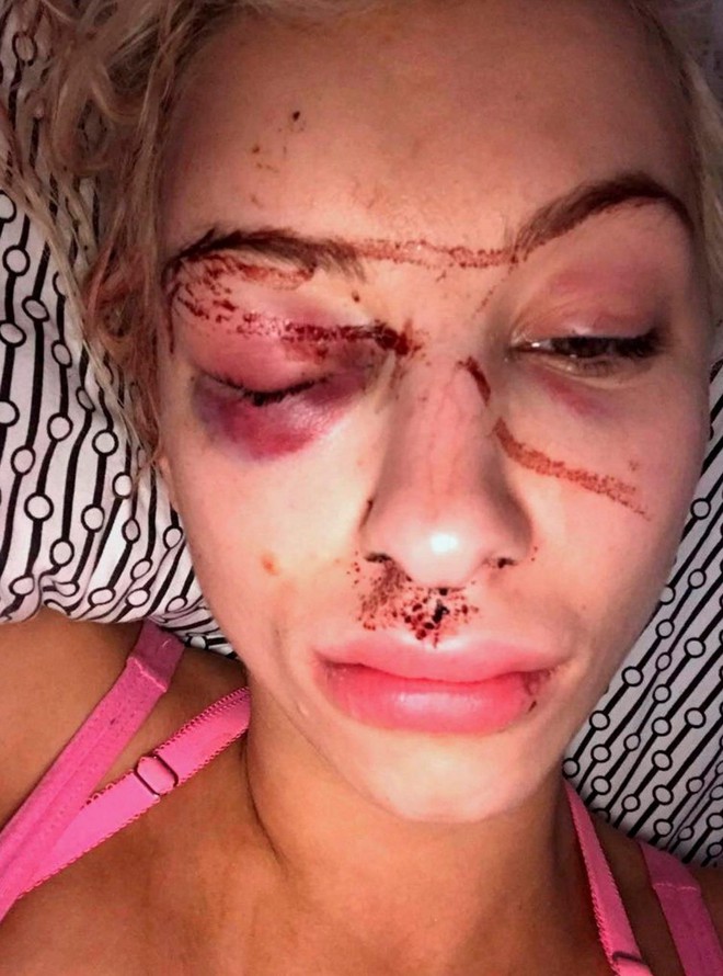 Nhìn ảnh tự sướng của bạn thân, cô gái lập tức gọi cảnh sát và giải cứu bạn sau 21 giờ kinh hoàng - Ảnh 2.