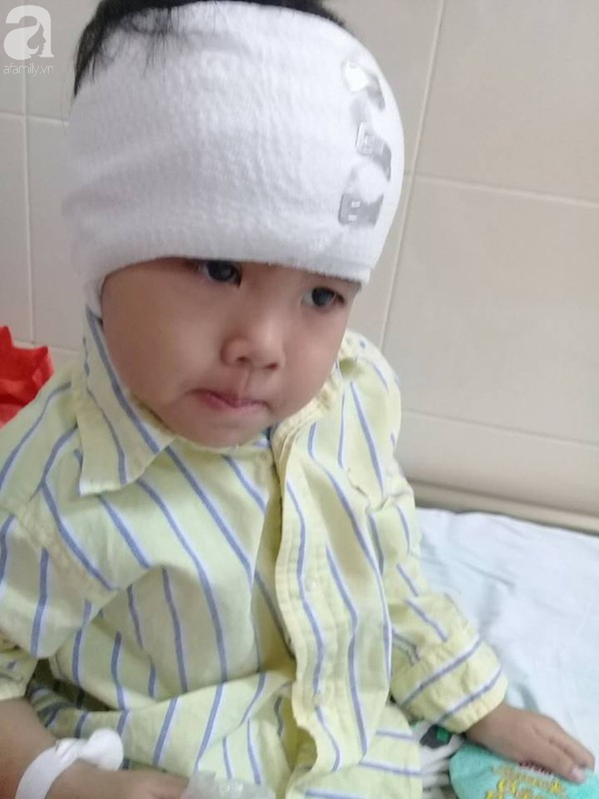 Hà Nội: Bé gái hơn  3 tuổi đau đớn tột cùng khi trải qua 2 lần phẫu thuật trị xạ u não - Ảnh 2.