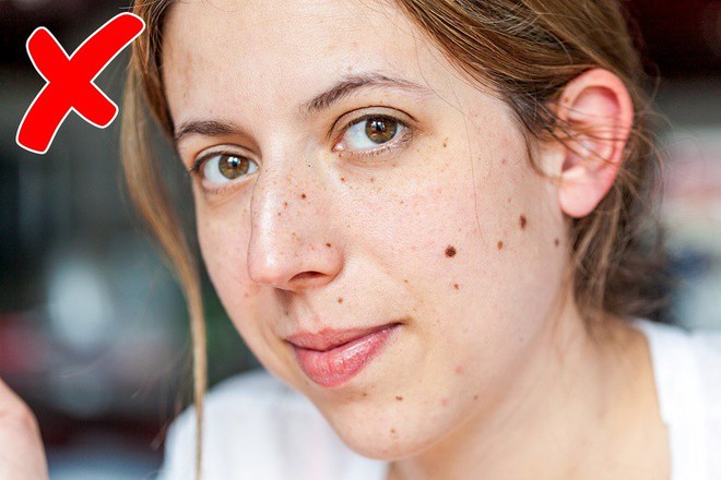 12 dấu hiệu trên khuôn mặt tiết lộ tình trạng sức khỏe của bạn - Ảnh 6.