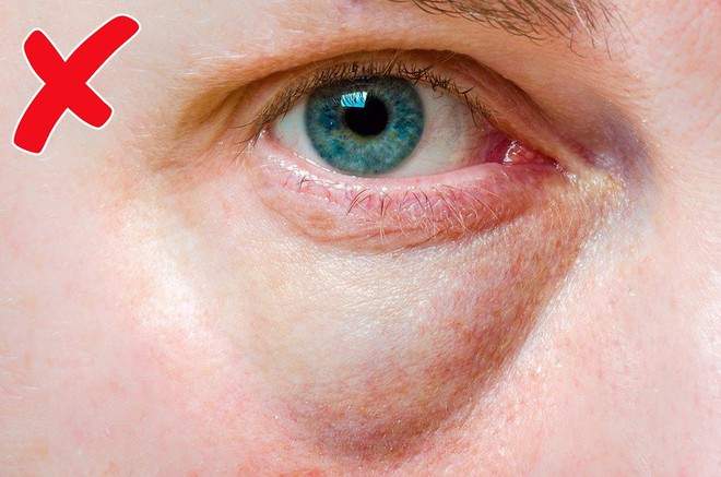 12 dấu hiệu trên khuôn mặt tiết lộ tình trạng sức khỏe của bạn - Ảnh 10.