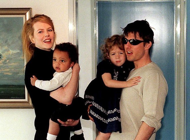 18 năm sau khi ly hôn với Tom Cruise, Nicole Kidman đau đớn kể lại về hai lần bị mất con - Ảnh 2.