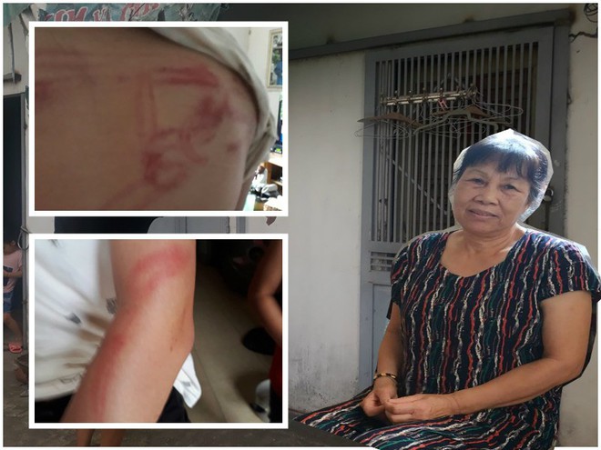 Vụ bố dùng tuýp sắt đánh con như kẻ thù: Người mẹ lên tiếng - Ảnh 2. Vụ bố dùng tuýp sắt đánh con như kẻ thù: Người mẹ lên tiếng - Ảnh 2.