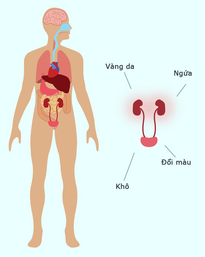 Tỉnh táo với 10 dấu hiệu không rõ ràng nhưng lại là tín hiệu cho thấy thận của bạn đang có vấn đề - Ảnh 2.