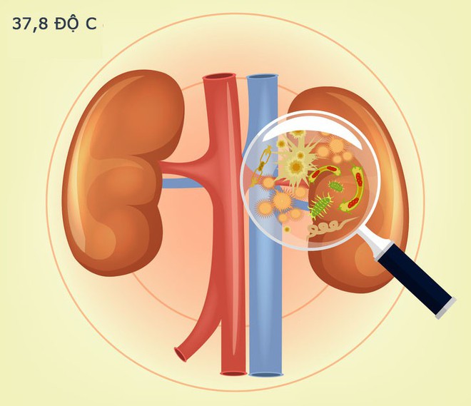 Tỉnh táo với 10 dấu hiệu không rõ ràng nhưng lại là tín hiệu cho thấy thận của bạn đang có vấn đề - Ảnh 7.