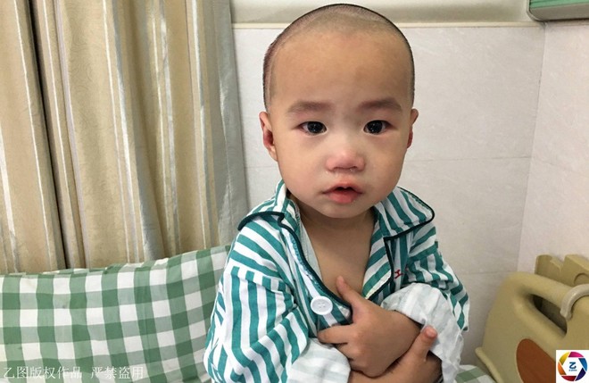 Trung Quốc: Hoàn cảnh thương tâm của bé trai 17 tháng tuổi bị bỏng toàn thân do một phút bất cẩn của bà - Ảnh 5.