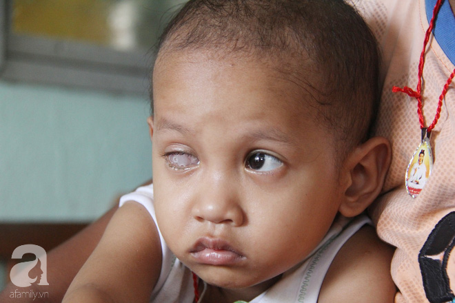 Xót cảnh bé gái 3 tuổi bị ung thư mắt, bố mẹ nghèo dành dụm tiền chở phân bò mong tìm lại ánh sáng cho con trong vô vọng - Ảnh 3.