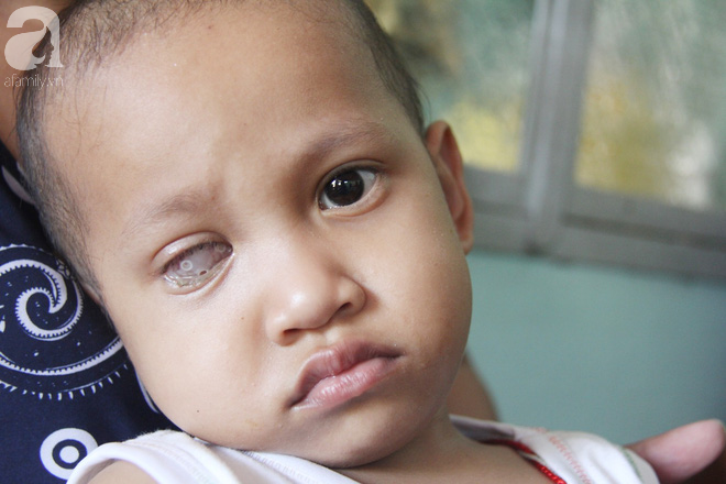 Xót cảnh bé gái 3 tuổi bị ung thư mắt, bố mẹ nghèo dành dụm tiền chở phân bò mong tìm lại ánh sáng cho con trong vô vọng - Ảnh 12.