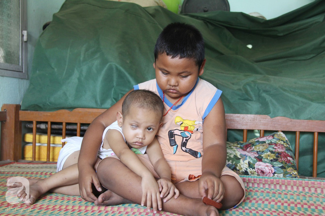 Xót cảnh bé gái 3 tuổi bị ung thư mắt, bố mẹ nghèo dành dụm tiền chở phân bò mong tìm lại ánh sáng cho con trong vô vọng - Ảnh 2.