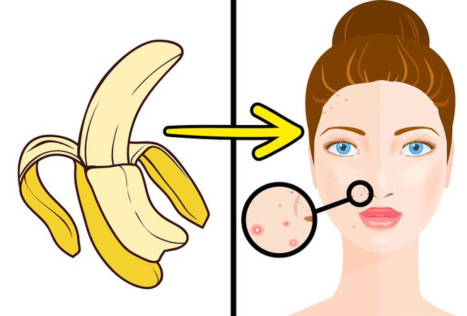 5 surprising benefits of banana peels, from scar treatment to anti-aging that make women amazed - Photo 1. 5 surprising benefits of banana peels, from scar treatment to anti-agin that make women amazed - Photo 1.
