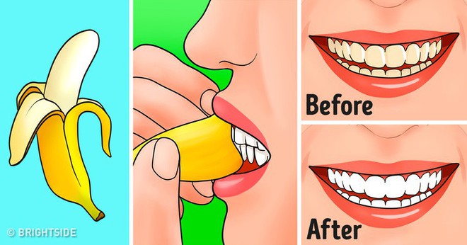 5 tác dụng ngạc nhiên chưa của vỏ chuối, từ trị sẹo đến chống lão hóa khiến chị em phải mắt tròn mắt dẹt - Ảnh 3.