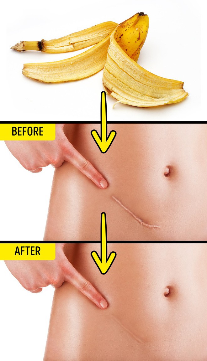 5 surprising benefits of banana peels, from scar treatment to anti-aging that make women amazed - Photo 4. 5 surprising benefits of banana peels, from scar treatment to anti-aging that make women amazed - Photo 4.