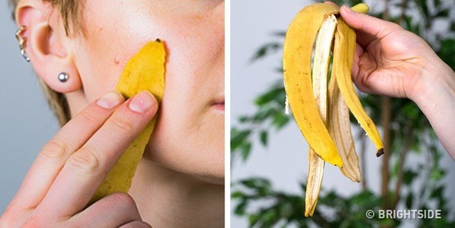 5 surprising benefits of banana peels, from scar treatment to anti-aging that make women amazed - Photo 5. 5 surprising benefits of banana peels, from scar treatment to anti-aging that make women amazed - Photo 5.