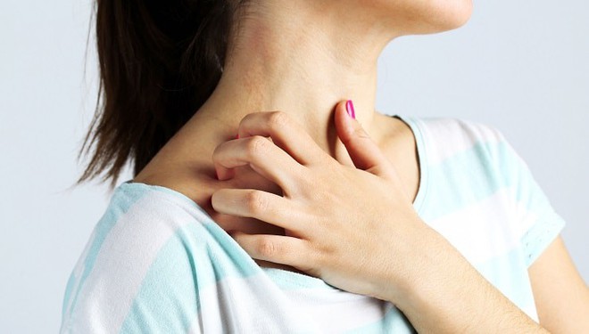 8 cách đơn giản phòng ngừa bệnh về da chàm eczema trong mùa đông - Ảnh 1.
