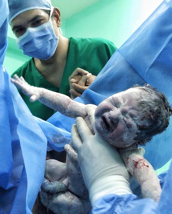Chạm đáy cảm xúc với hình ảnh em bé ngọ nguậy chui ra từ vết rạch trên bụng mẹ khi sinh mổ - Ảnh 11.