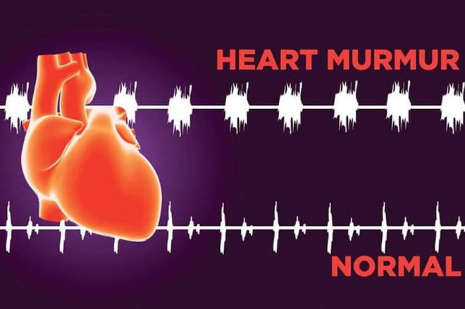 9 dấu hiệu cho thấy bạn có thể mắc bệnh van tim - Ảnh 1.