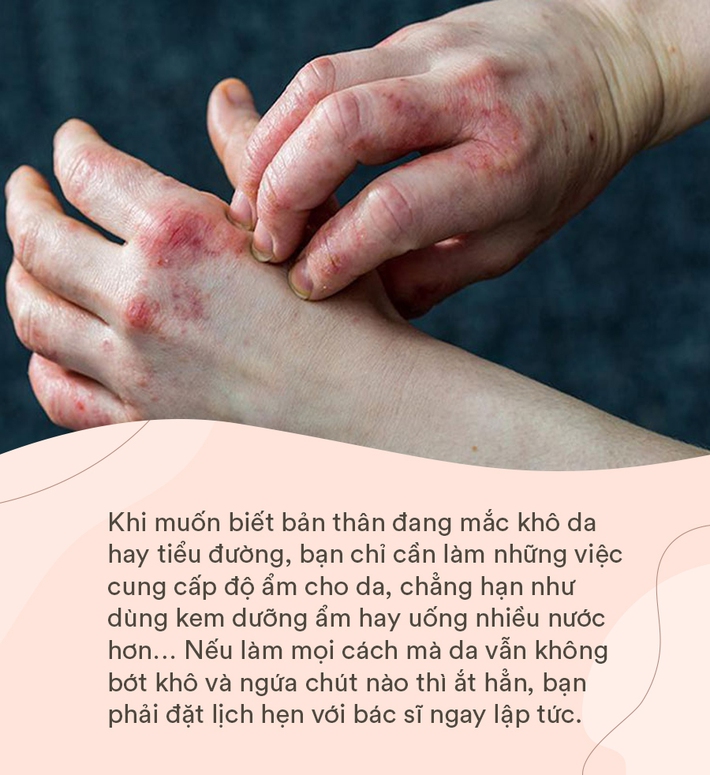 Tiểu đường đang “rình rập” trong cơ thể nếu bạn có một trong 6 dấu hiệu này trên da:  Đa phần hệt như viêm da thường thấy khiến nhiều người chủ quan - Ảnh 3.