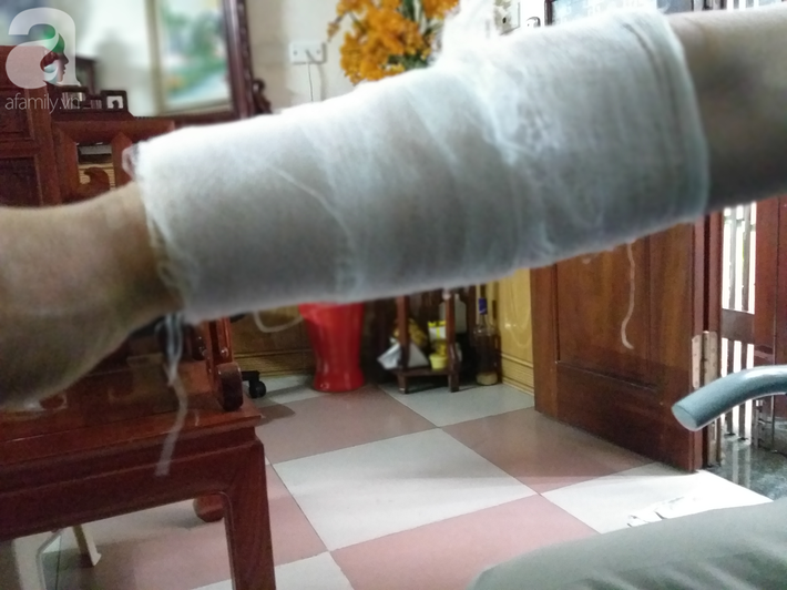 Chủ nhà bị bỏng nhẹ khi lao vào cứu các nạn nhân
