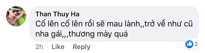 Sao Việt xót xa cho gương mặt bị bỏng của Hồng Ngọc, hy vọng cô giữ vững tinh thần để mau chóng hồi phục - Ảnh 7.