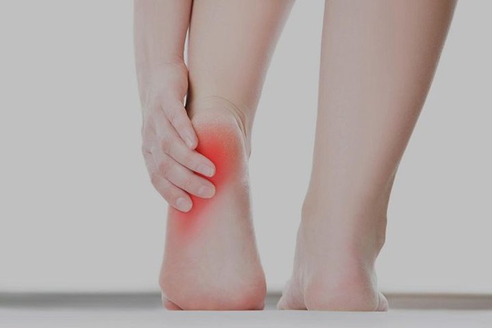 Người phụ nữ bị đau gót chân, không nhờ phát hiện khối u, cảnh giác đau gót chân liên quan đến 4 bệnh - Ảnh 2.