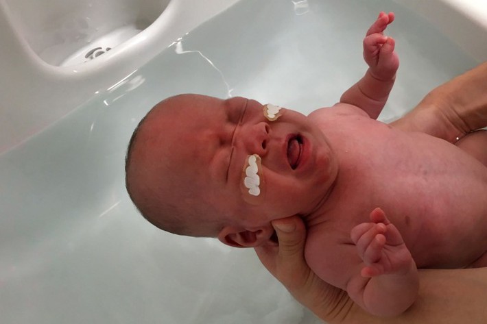 Chào đời nặng 268gr, bé trai sinh non nhỏ nhất thế giới 