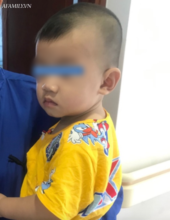 Tai nạn kinh hoàng: Mẹ đi pha sữa cho bú, bé trai 10 tháng tuổi bò xuống gầm bàn nuốt mảnh kính bể vào bụng - Ảnh 2.