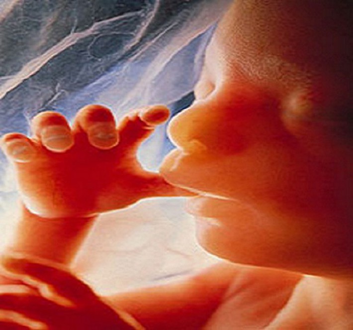 15 năm sau khi phá thai, bà mẹ choáng váng khi phát hiện con vẫn còn trong bụng và bí mật về hiện tượng bào thai 